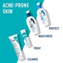 CeraVe Limpiador Crema Espumoso contra Acne 150ml
