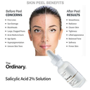 The Ordinary Salicylic Acid 2% Solution | Ácido Salicílico 30ml